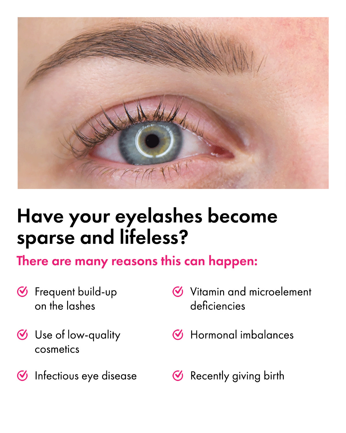 Toplash eyelash and eyebrow booster - Ripsiseerumi — 3 ml
